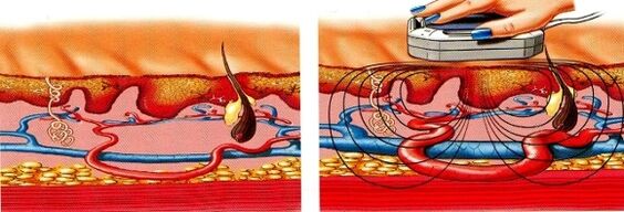 si tes jambes deviennent engourdies